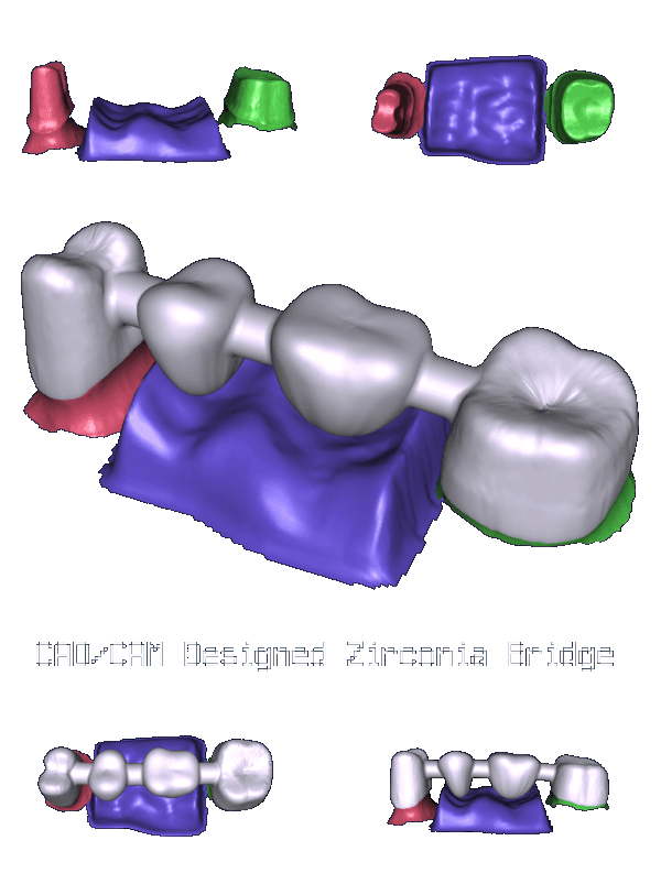 Dental Products CAD/CAM PETERS DENTAL CERAMIC STUDIO LTD. TORONTO, CANADA